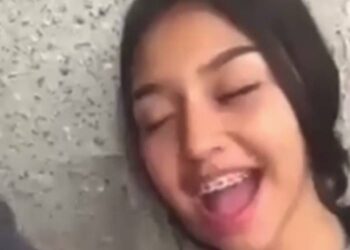 Watch SkyLeakks Braces Girl Full Video Twitter • Braces Girl Video